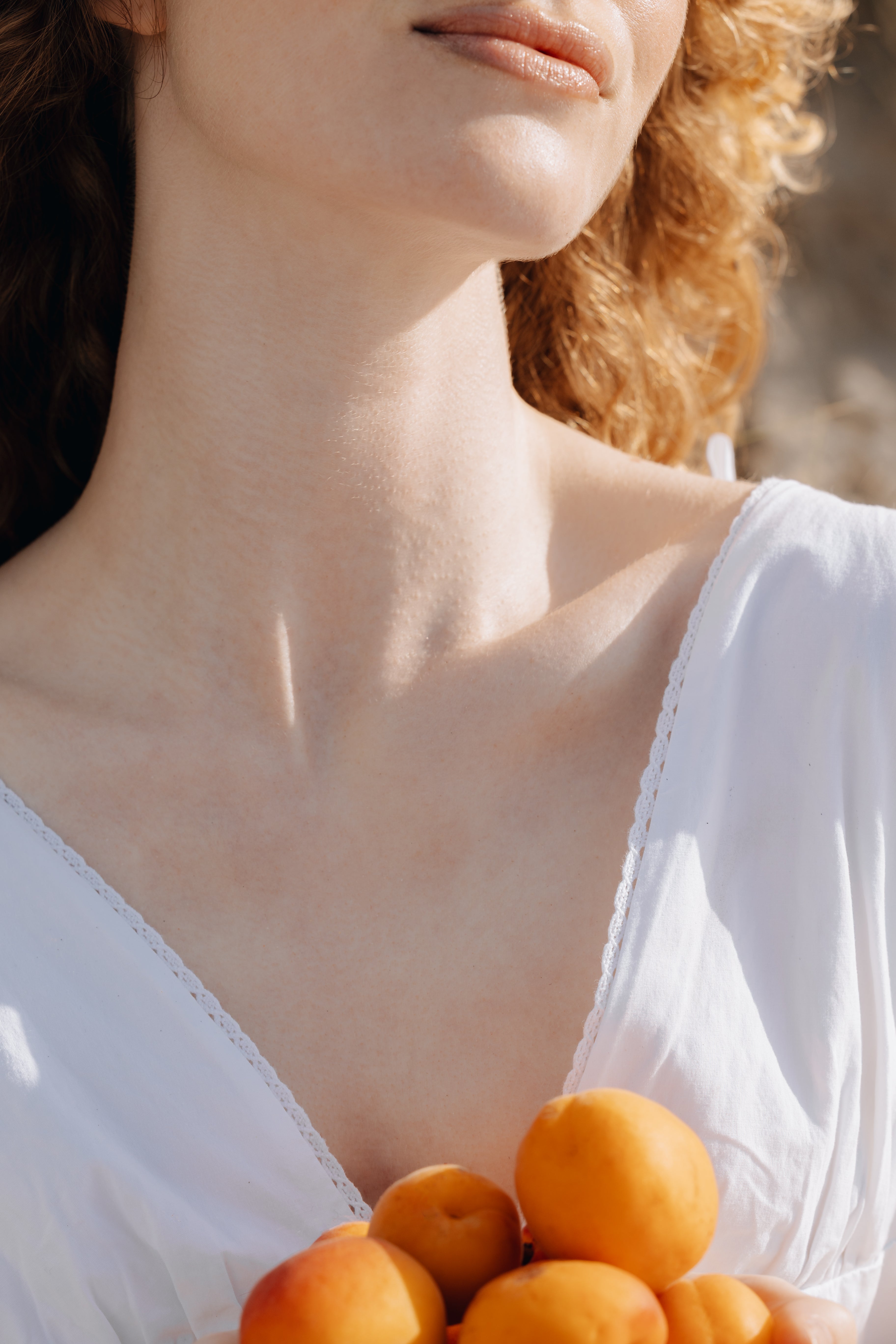 Psoriasis